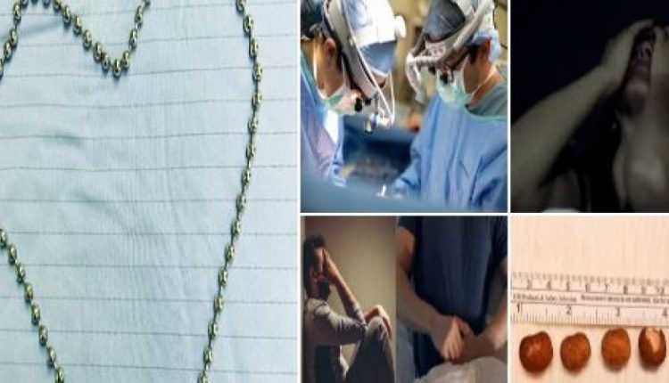 चरमसुख, गुप्तांग, मोशन की माला, orgasm, genitals, rosary of motion