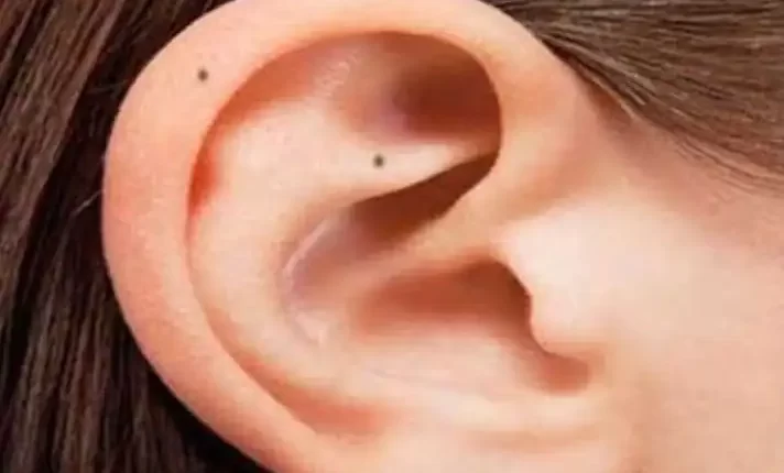 तिल के मायने, कान पर तिल, सामुद्रिक शास्त्र, Meaning of mole, mole on ear, oceanography