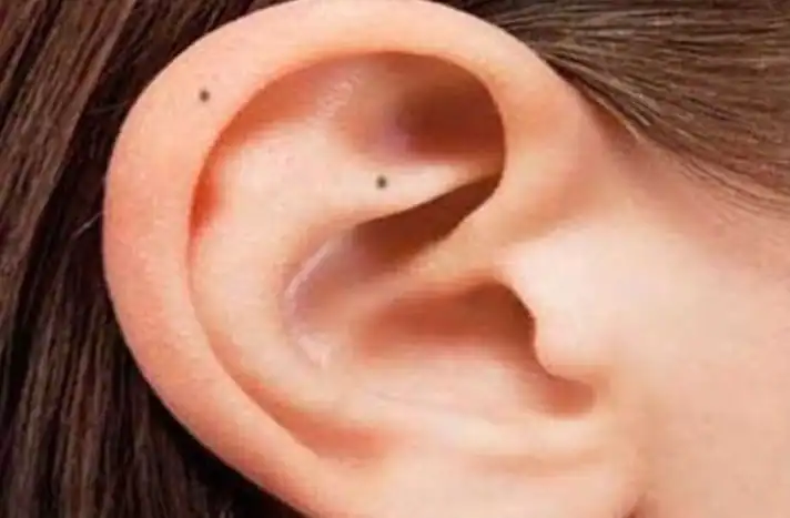 तिल के मायने, कान पर तिल, सामुद्रिक शास्त्र, Meaning of mole, mole on ear, oceanography