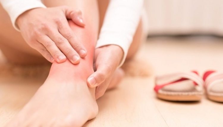 सूजन, पैरों में तकलीफ, घरेलू उपाय, Swelling, Sore Feet, Home Remedies